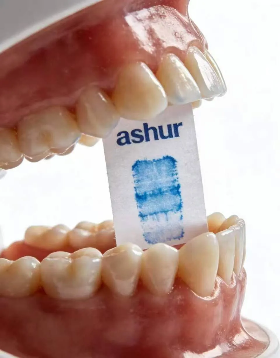 Full-mouth rehabilitation