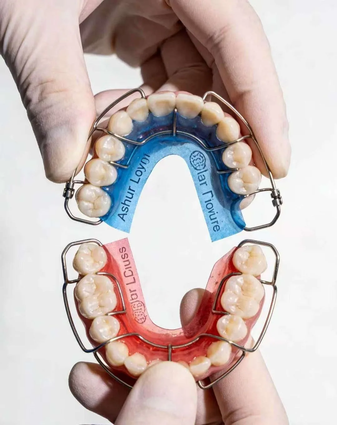 Orthodontic and sensitive cases