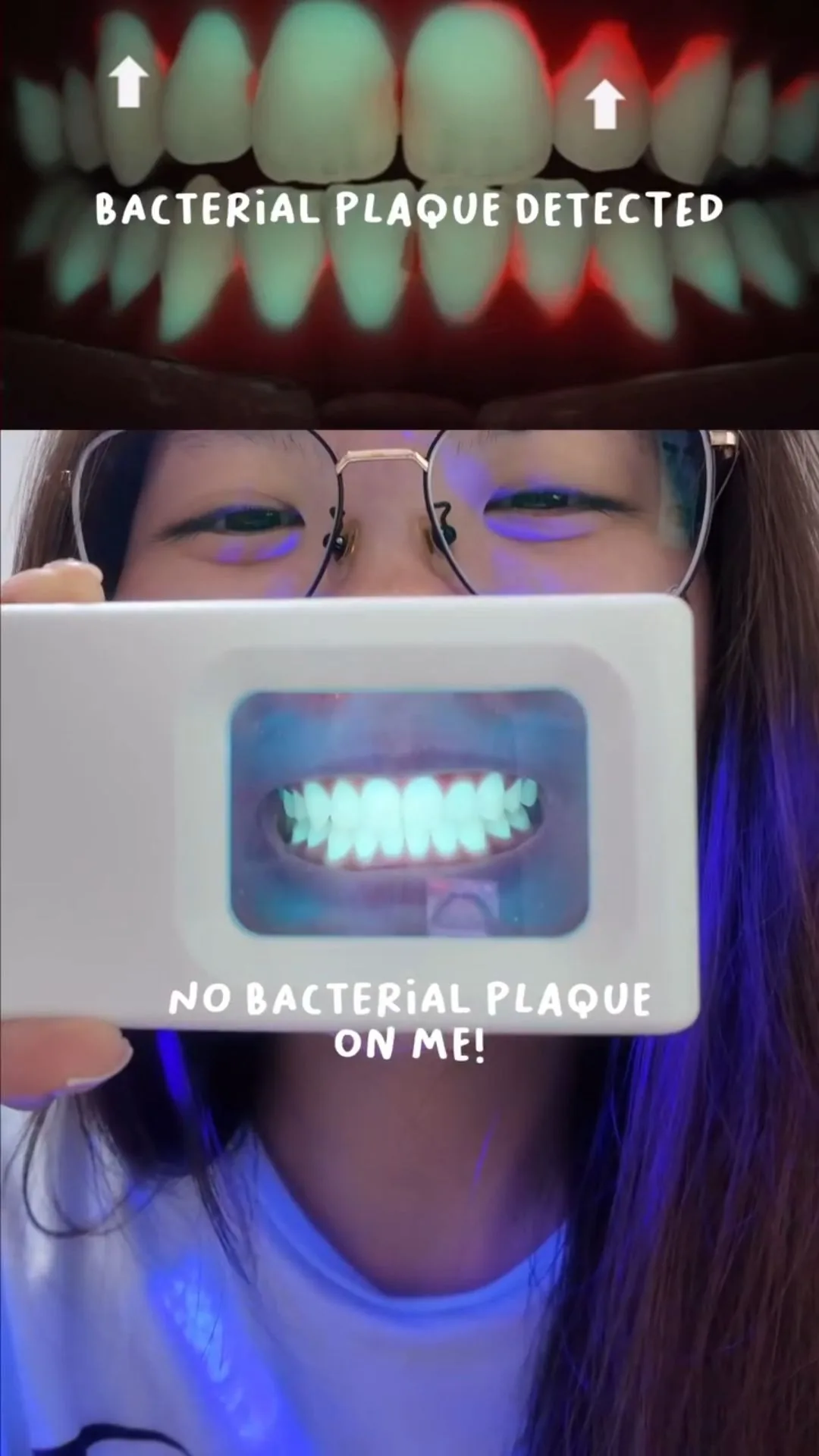 Person holding a plaque-light viewer displaying teeth, image 11