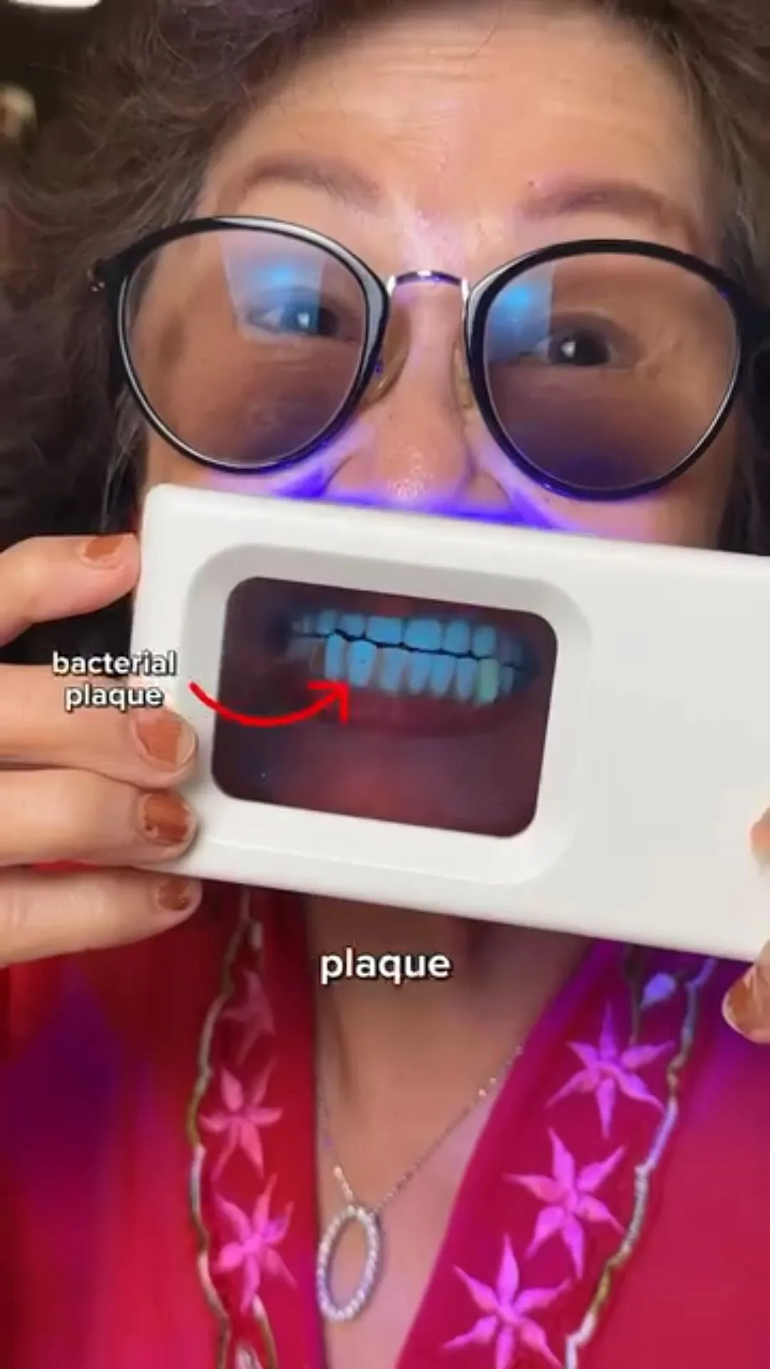 Person holding a plaque-light viewer displaying teeth, image 23