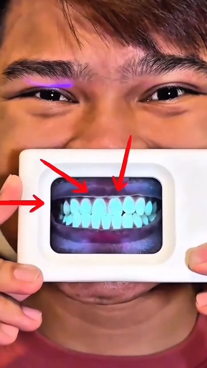 Person holding a plaque-light viewer displaying teeth, image 28