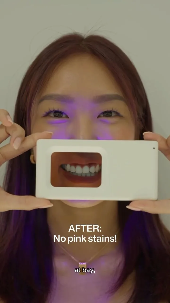 Person holding a plaque-light viewer displaying teeth, image 29