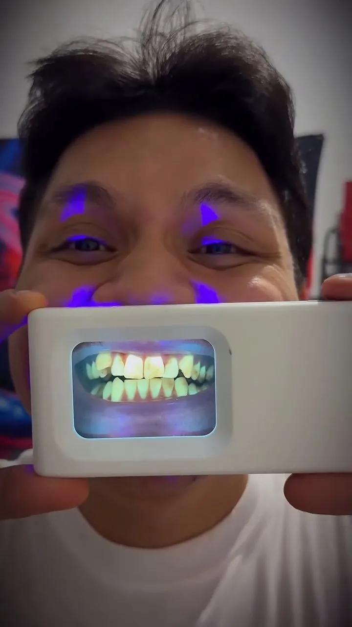 Person under violet illumination during a plaque-light demonstration, image 31