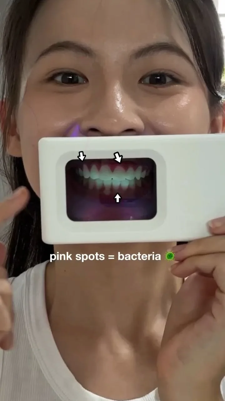 Person holding a plaque-light viewer displaying teeth, image 38