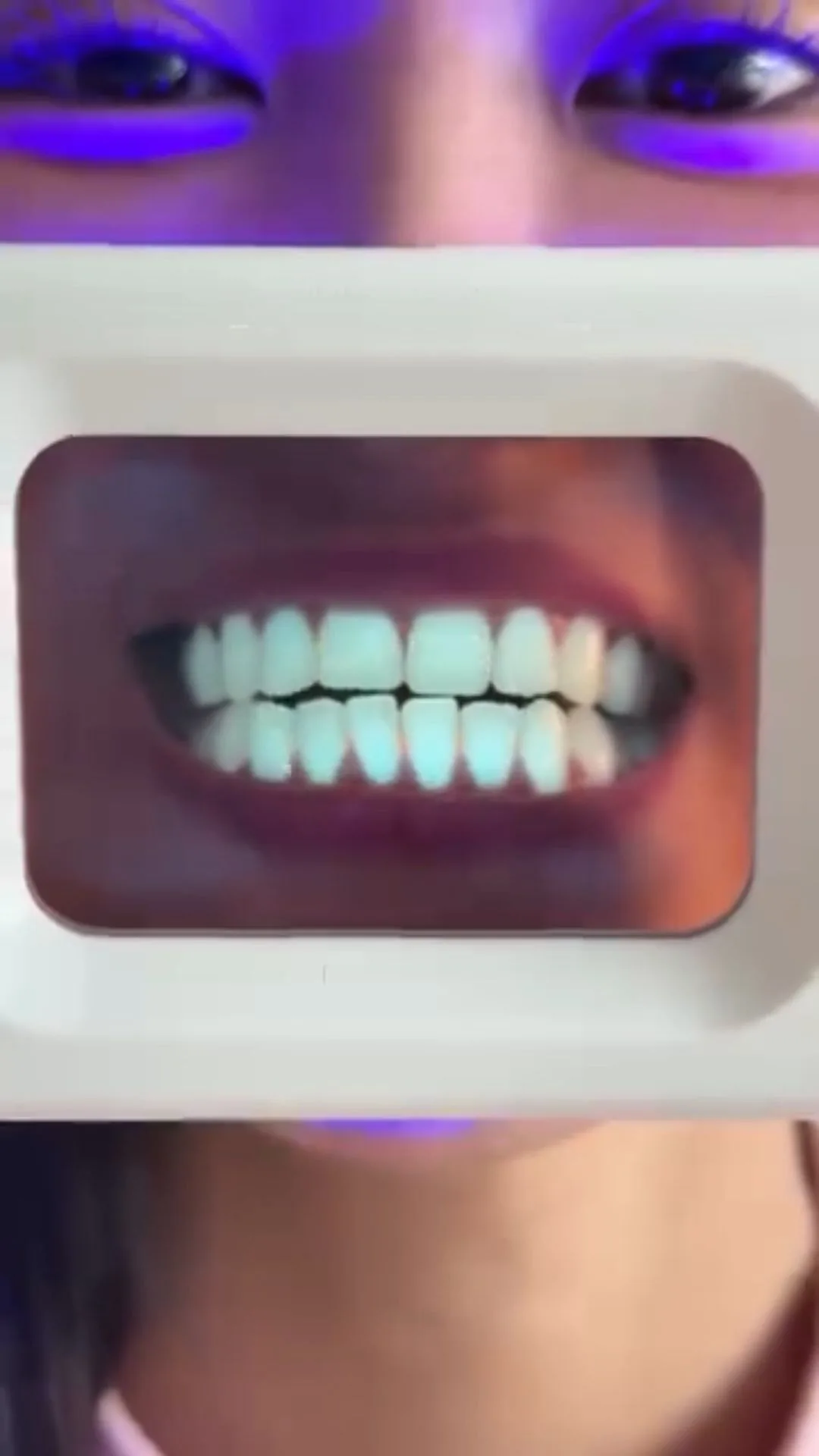 Person holding a plaque-light viewer displaying teeth, image 44