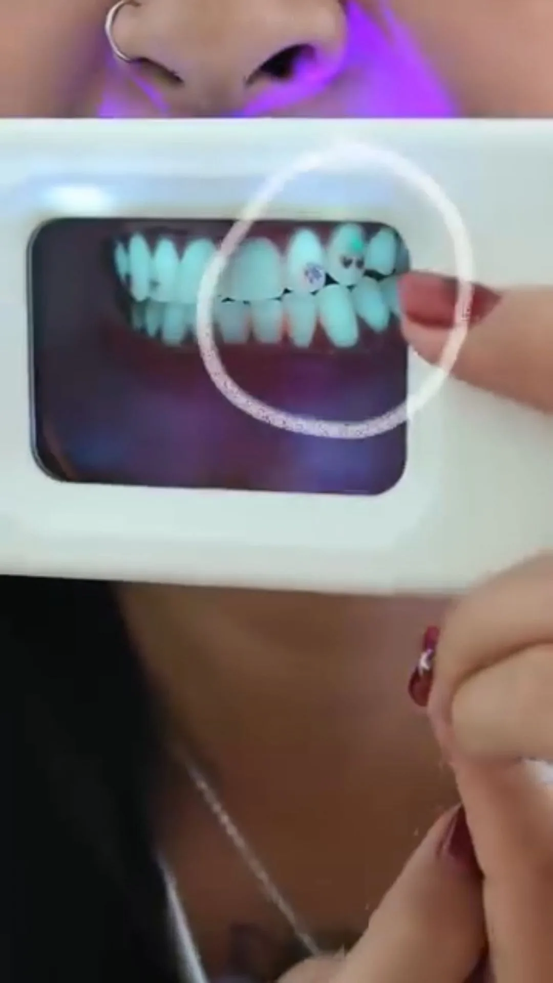 Person holding a plaque-light viewer displaying teeth, image 46