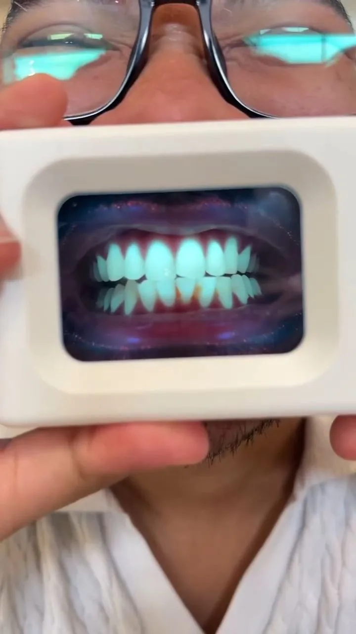 Person holding a plaque-light viewer displaying teeth, image 48